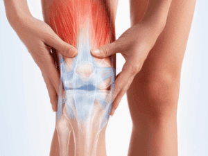 Arthritis